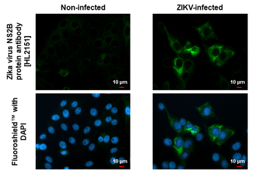 Anti-Zika virus NS2B protein antibody [HL2151] used in Immunocytochemistry/ Immunofluorescence (ICC/IF). GTX638129